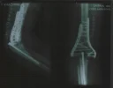 New Xrays.webp
